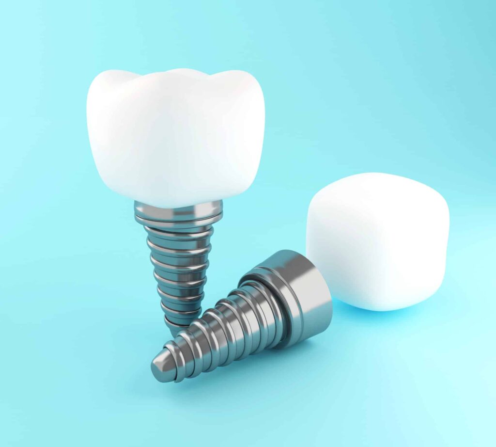 types of dental implants