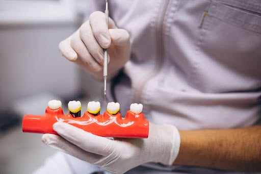 Understanding Dental Crowns & Bridges: Pros, Costs & Care
