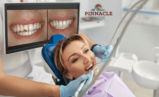 Cracked or Chipped Tooth