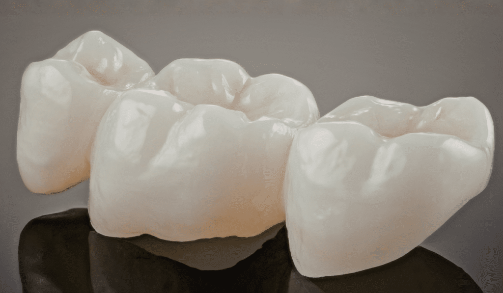 Biomimetic Dentistry vs Traditional Dentistry