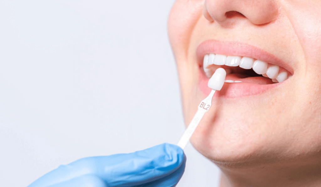 Cosmetic Dentistry Planning in Colorado Springs