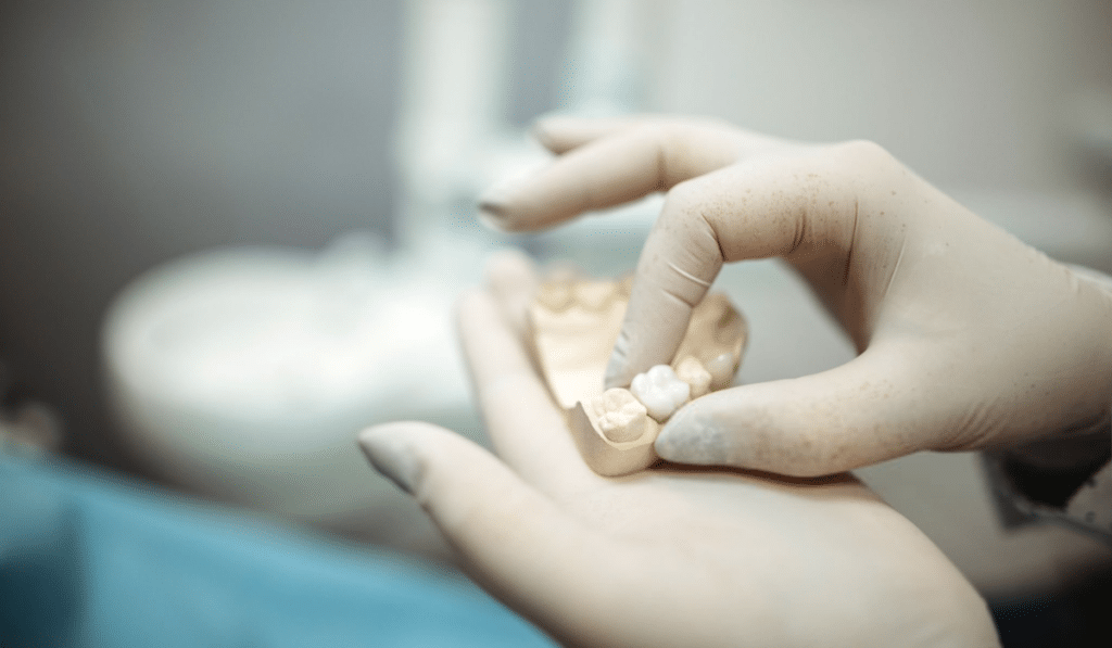 dental crowns colorado springs