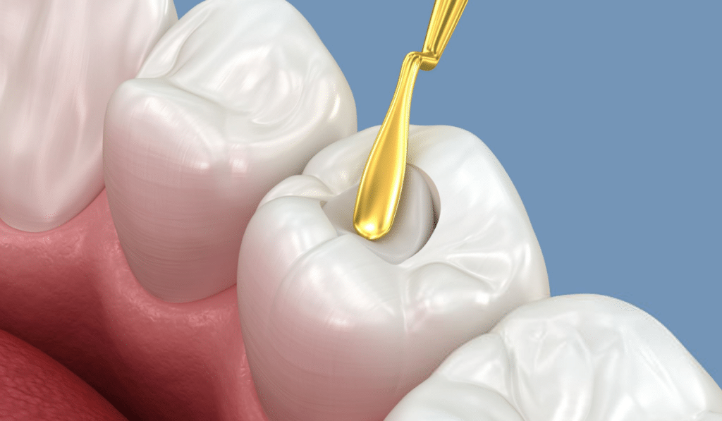 restorative dentistry colorado springs