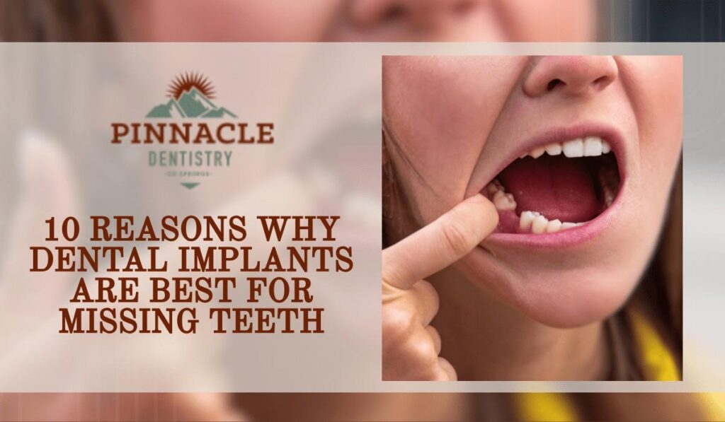 Dental Implants Are Best for Missing Teeth