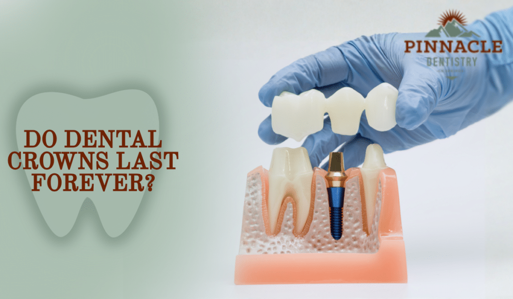 Do Dental Crowns Last Forever? Discover Their Durability