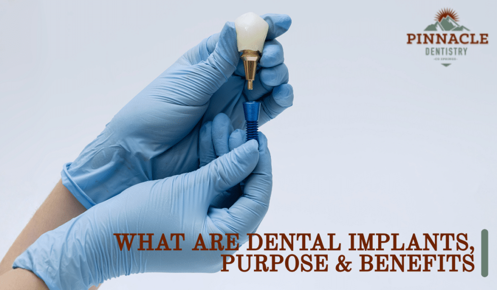 What are dental implants