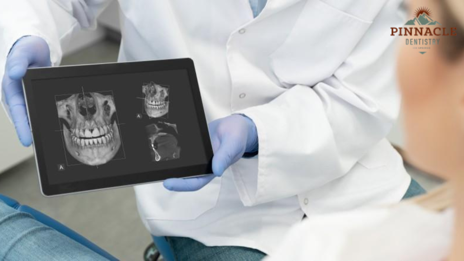 The Importance of 3D Imaging for Precise Dental Implants