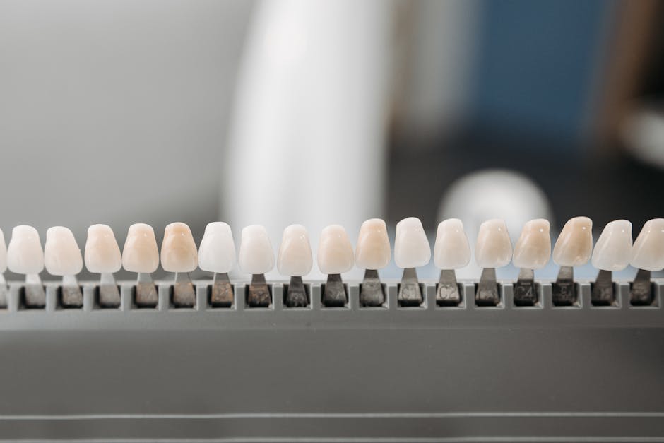 dental bridge material options