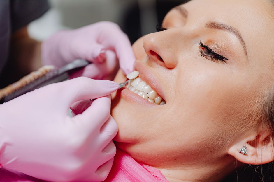 chipped tooth cosmetic dentist