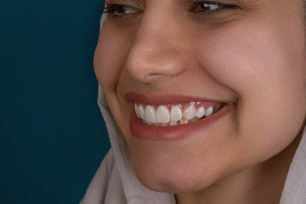 porcelain veneers full mouth smile makeover