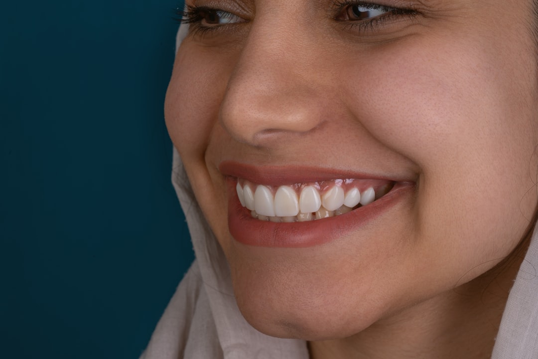 porcelain veneers full mouth smile makeover